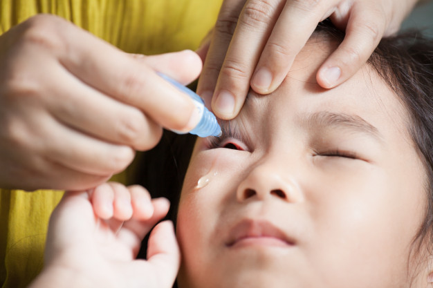 散瞳劑阿托品眼藥水/滴眼液 (Atropine) 如何控制近視？副作用, 高濃度 vs 低濃度？